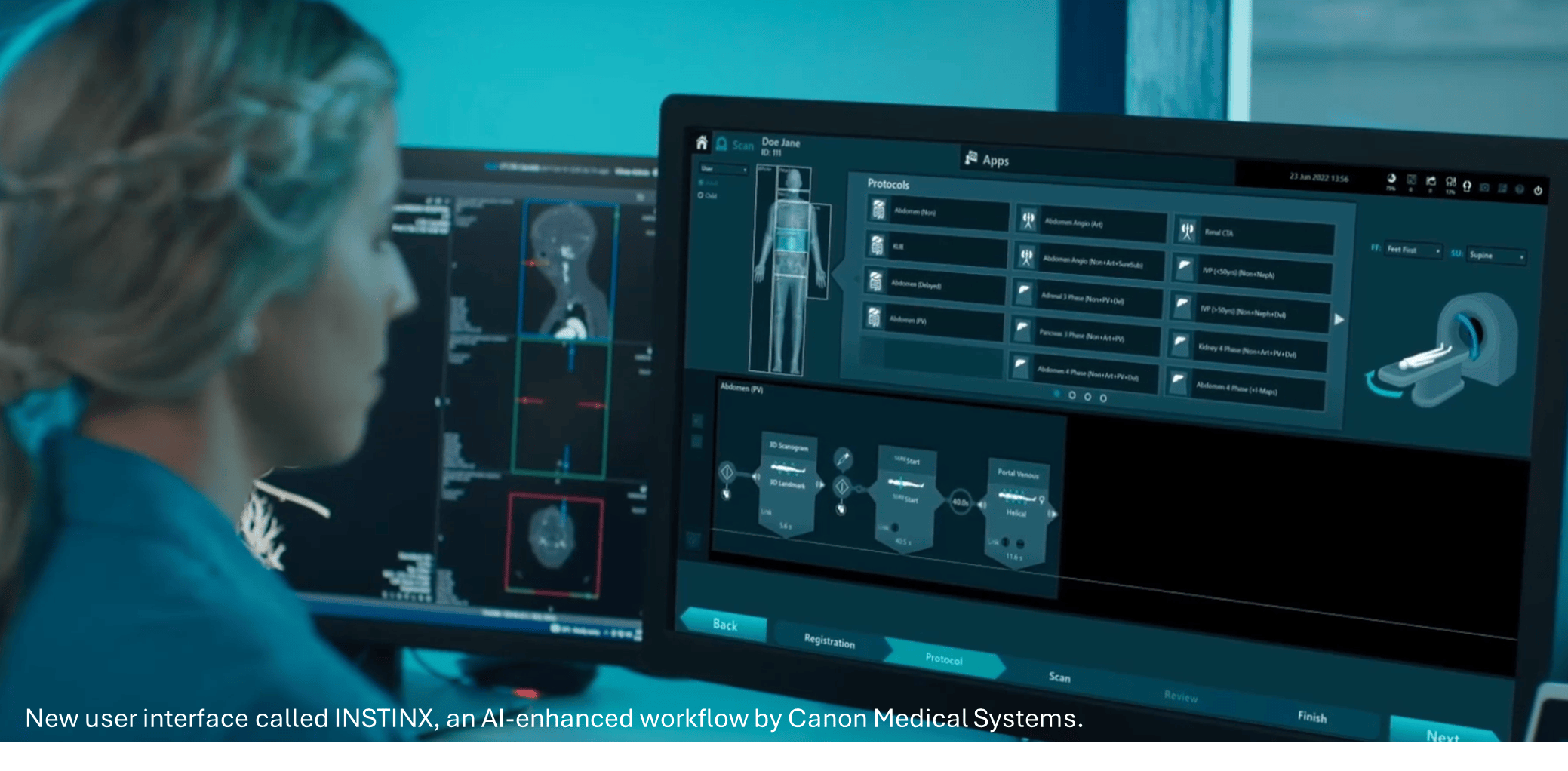 AI for Quality and Efficiency in Radiology