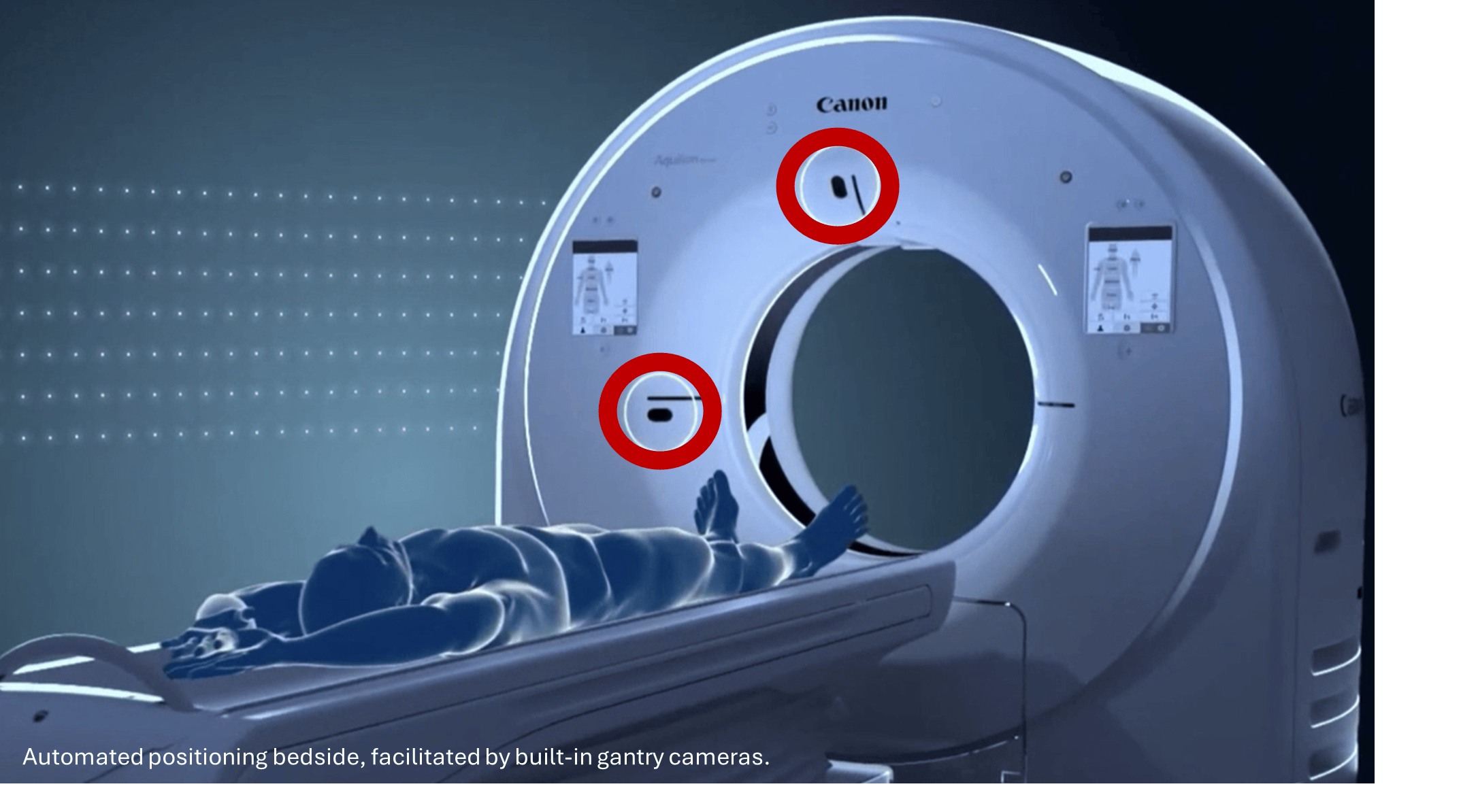 Automatic Rescaling Radiography AI for Quality and Efficiency in Radiology